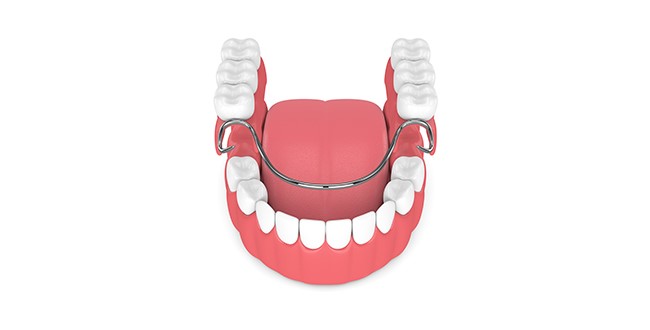 Permanent Dentures Cost Custar OH 43511